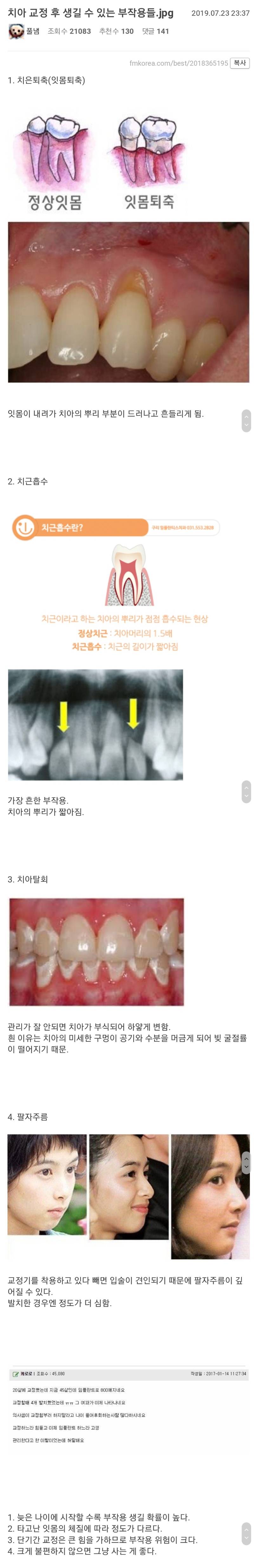 치아 교정 후 생길 수 있는 부작용들 | 인스티즈