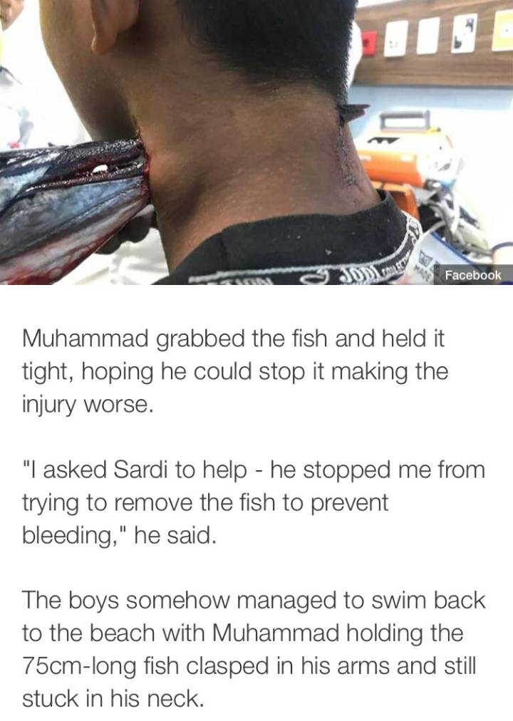 물고기에게 목을 찔린 소년 (충격이미지 주의) | 인스티즈