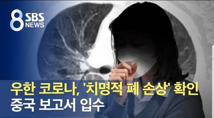 우한 코로나 '치명적 폐 손상' 확인 중국보고서 입수 | 인스티즈