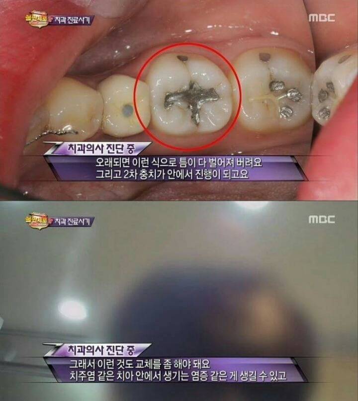 치과의사기꾼들에게 호갱 안 당하는 법 | 인스티즈