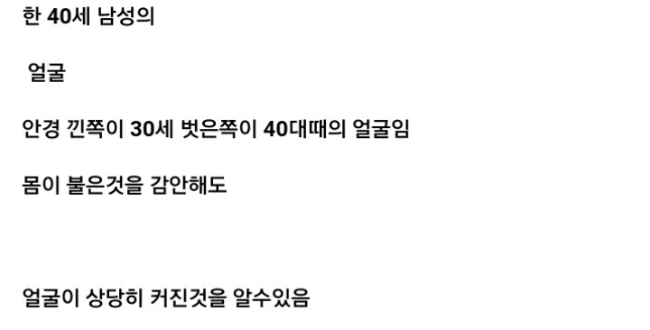 나이 먹으면 얼굴이 커지는 이유 | 인스티즈