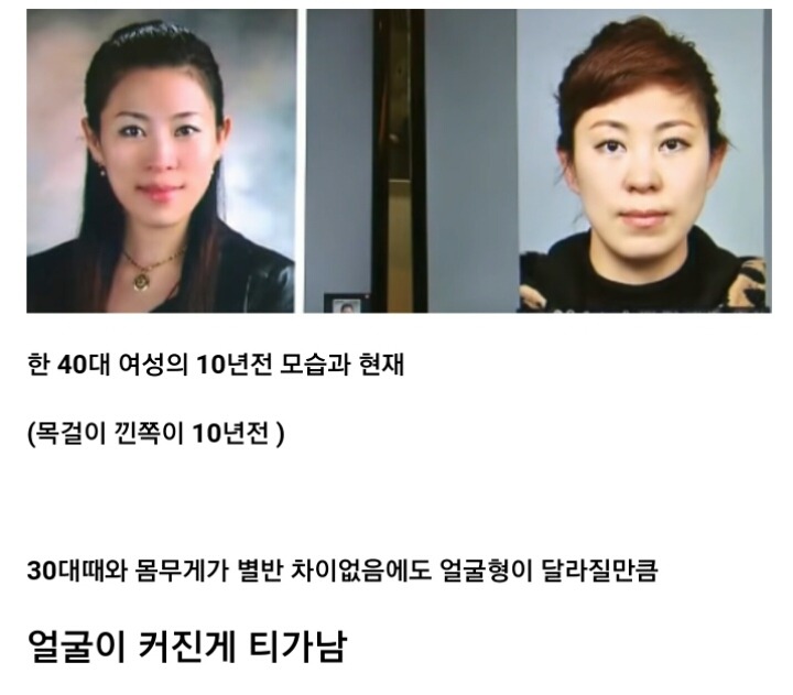 나이 먹으면 얼굴이 커지는 이유 | 인스티즈