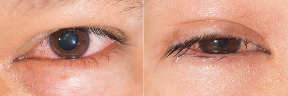 비염 유니버스...jpg | 인스티즈