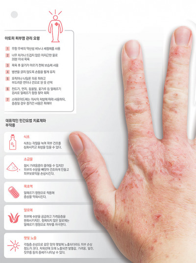 비염 유니버스...jpg | 인스티즈