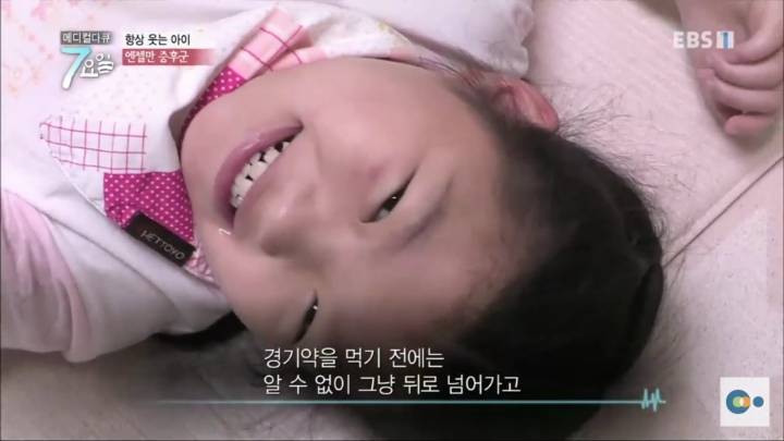 평생 웃으면서 사는병 엔젤만증후군 | 인스티즈