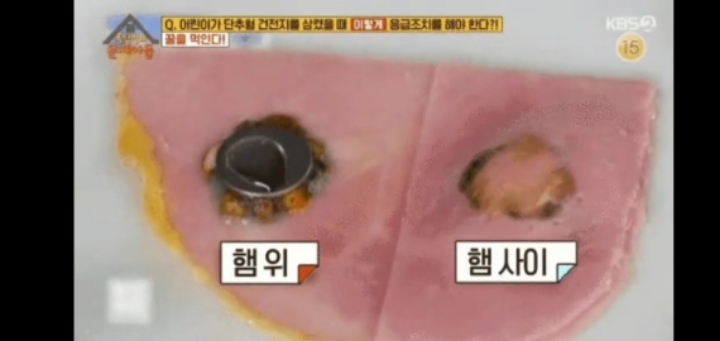 단추형 건전지를 삼키면 절대 안되는 이유.jpg | 인스티즈