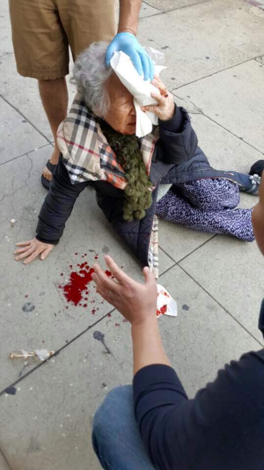 LA 한인할머니 트럼프지지자에게 폭행당해 | 인스티즈