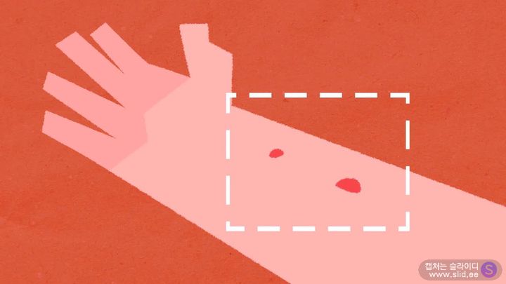 슬슬 걱정되기 시작하는 이 놈에 대해 자세히 알아보자.jpg | 인스티즈