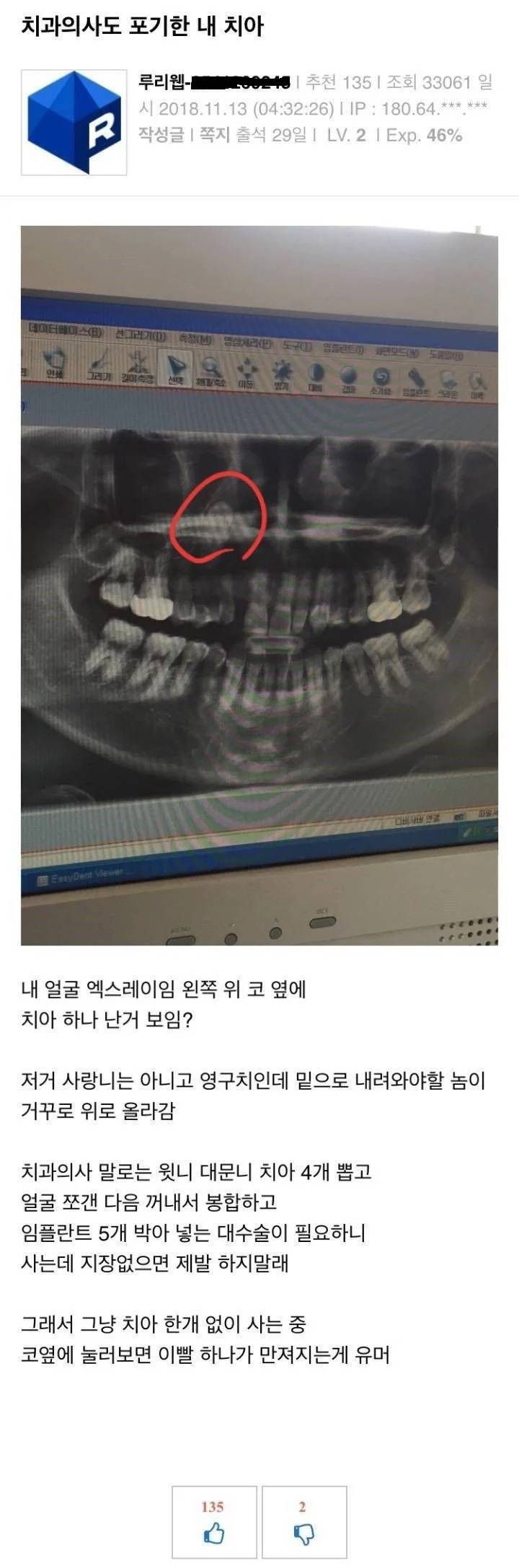 치과의사도 포기한 치아...jpg | 인스티즈