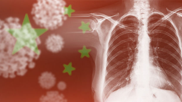 중국 코로나 위중환자 90% 퇴원 후에도 폐 손상 | 인스티즈