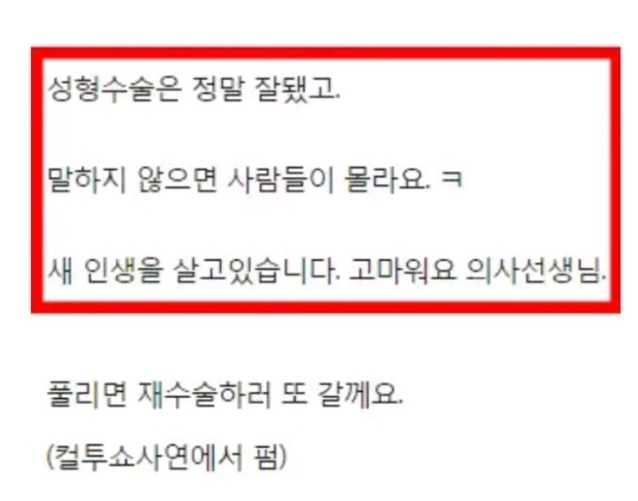 한 여자분의 쌍수후기 | 인스티즈