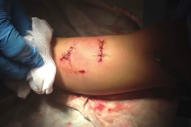 아이 공격하는 맹견 혼내주는 갓냥이 | 인스티즈