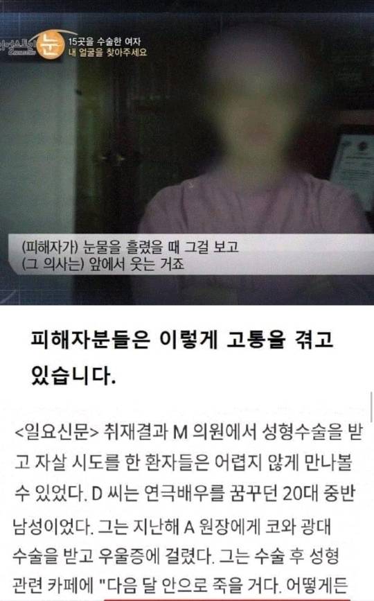 일부러 수술을 망치는 사이코패스 의사 | 인스티즈