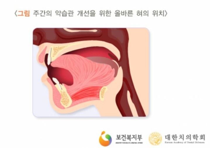 충격적인 원래 혀의 위치 ㄷㄷ.jpg | 인스티즈