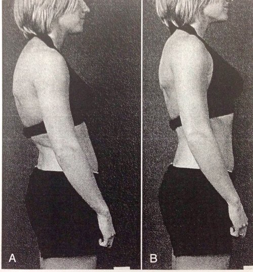 오래 앉아있으면 생기는 골반 전방 경사에 관하여 | 인스티즈