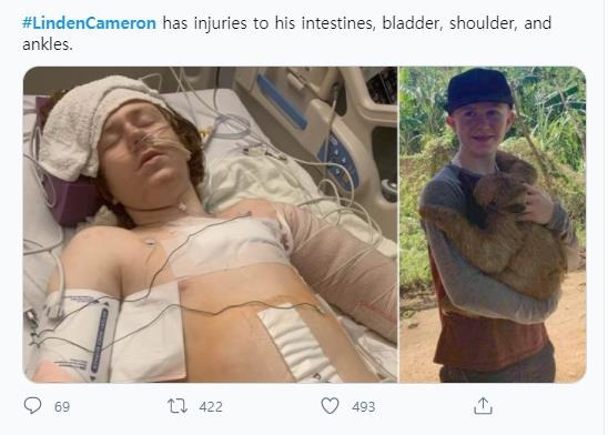 집에서 소란 피운 13살 자폐아에게 수발 쏜 미 경찰..아이 중태 | 인스티즈