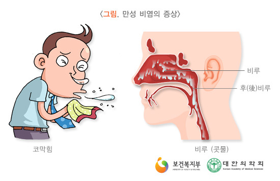 유산균 먹고 비염 개선됐다 vs 효과 없다 | 인스티즈