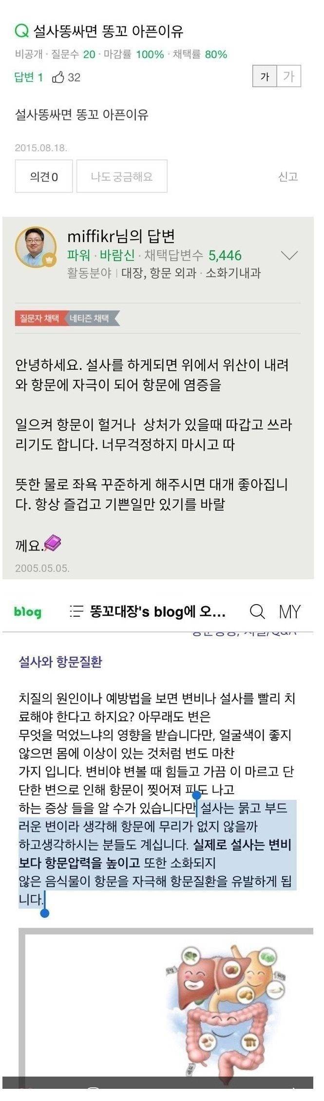 설사하면 항문아픈이유 | 인스티즈