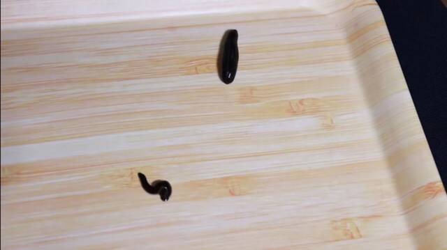 혐주의] 실제로 여드름에 효과적인라는 치료방법 | 인스티즈