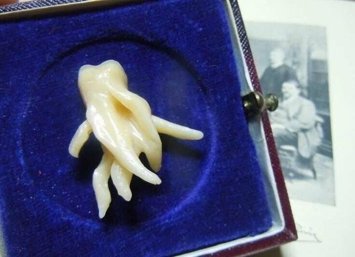 미친 사랑니 ㄷㄷㄷㄷ.JPG | 인스티즈