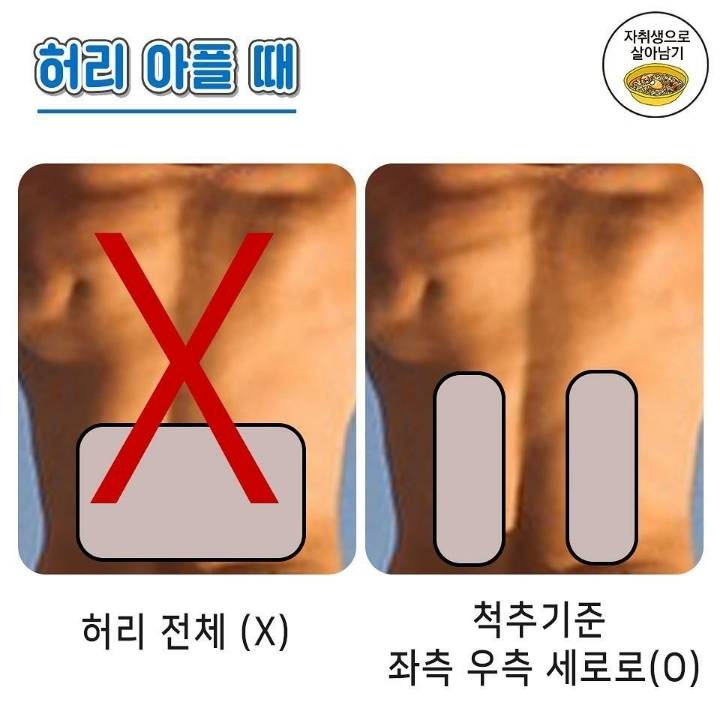 파스 붙이는 요령 | 인스티즈