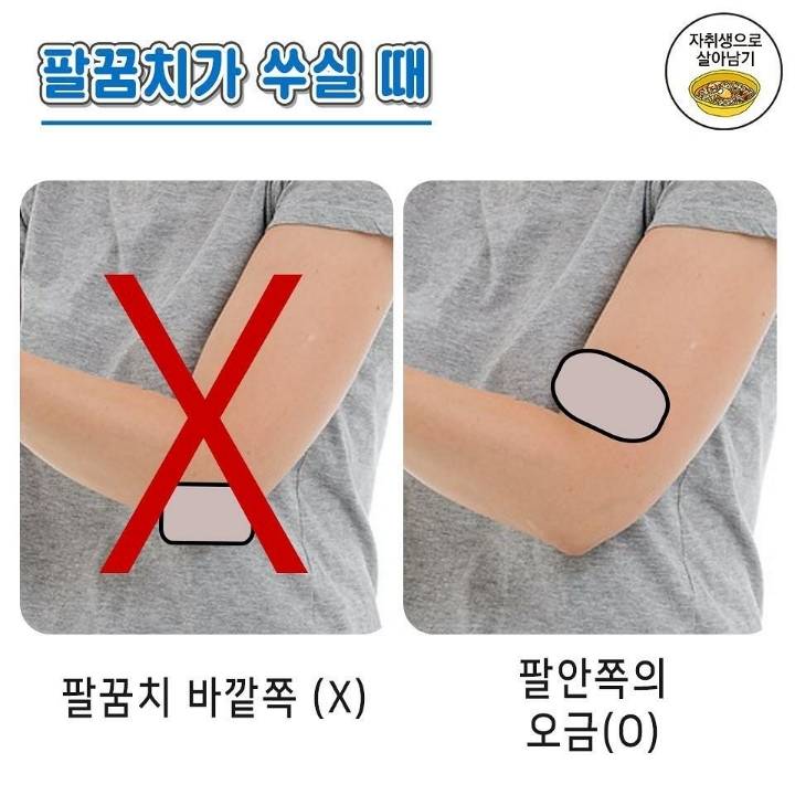 파스 붙이는 요령 | 인스티즈