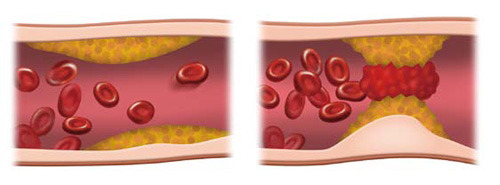 한번하는데 100만원인 바디 클리닝이 있다면 당신의 선택은? | 인스티즈