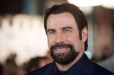 모발이식 성공사례 | 인스티즈