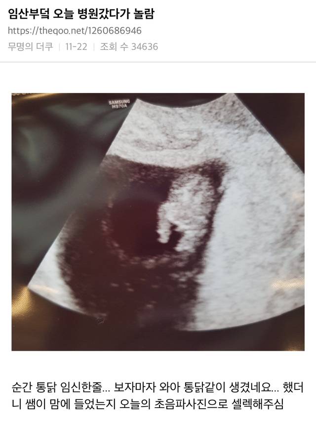 통닭을 임신한 임산부.jpg | 인스티즈