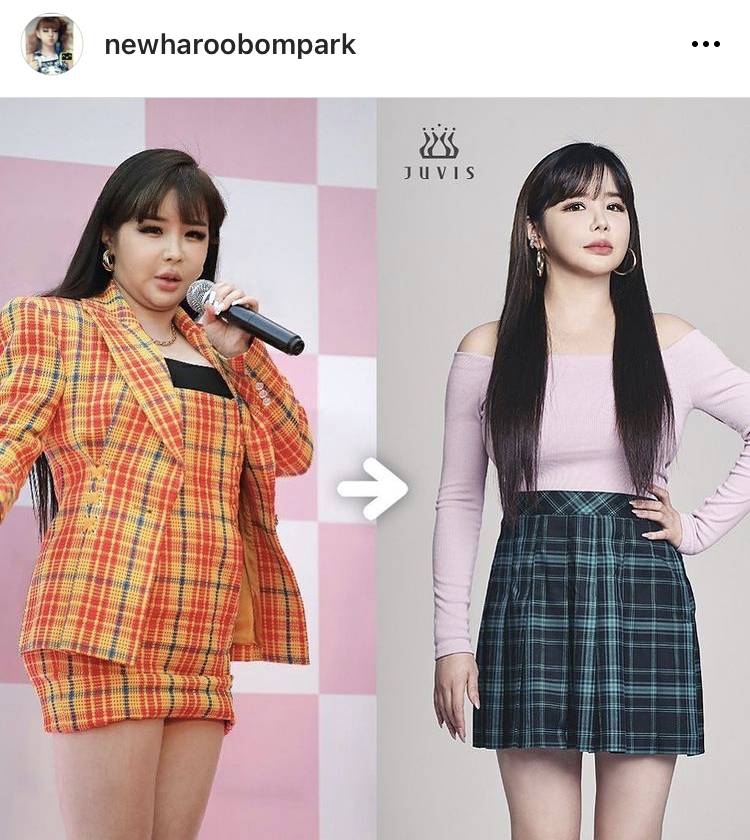 박봄 다이어트 성공 | 인스티즈