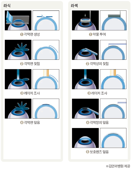 라식라섹차이 | 인스티즈