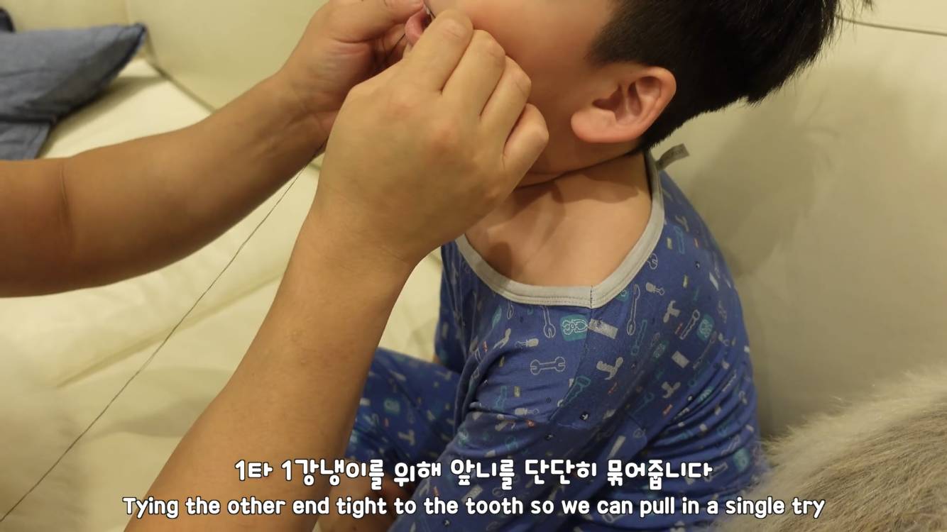 사모예드와 흔들리는 이 뽑는 법 | 인스티즈