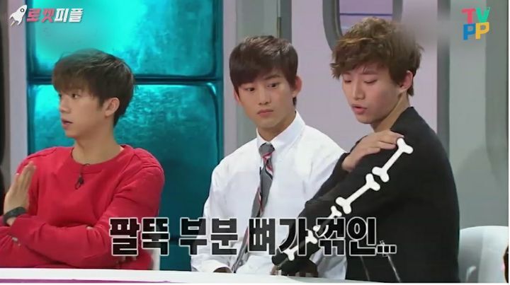 옥택연 팔에 흉터가 있는 이유 | 인스티즈