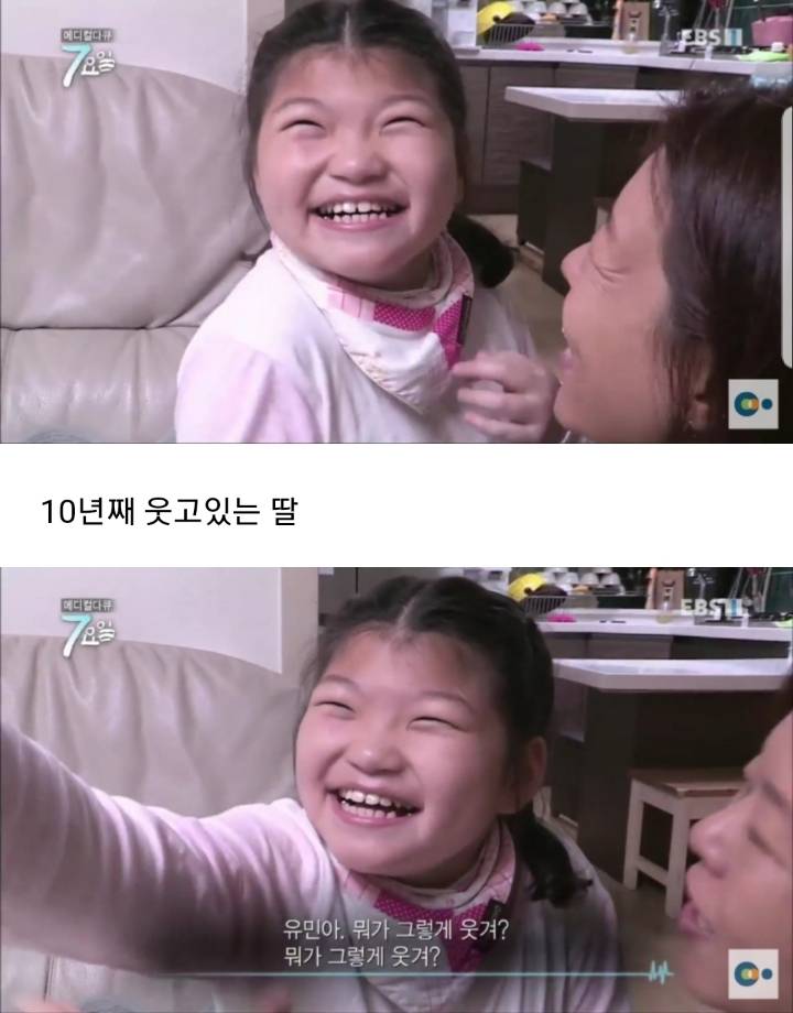 평생 웃으면서 살아야 하는 병 | 인스티즈