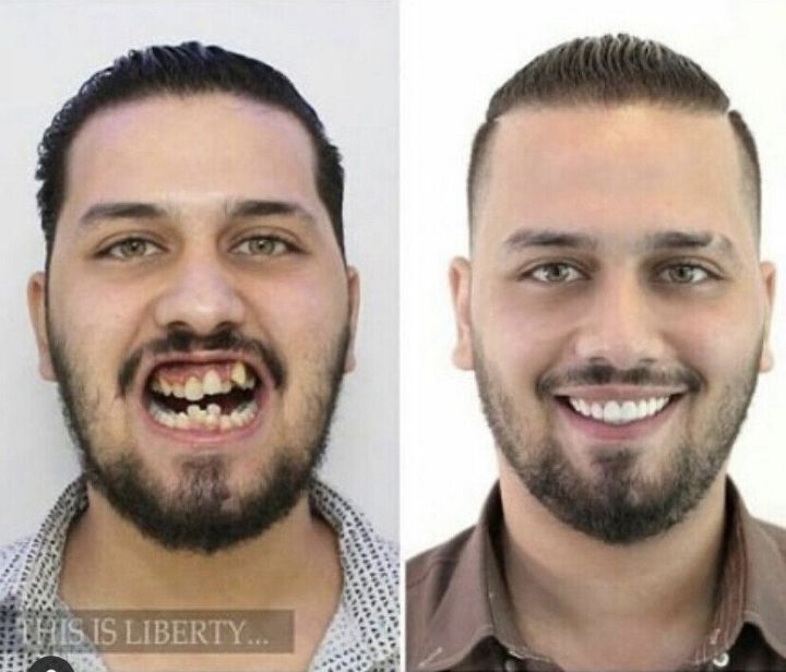 치아교정이 필요한 이유.JPG | 인스티즈