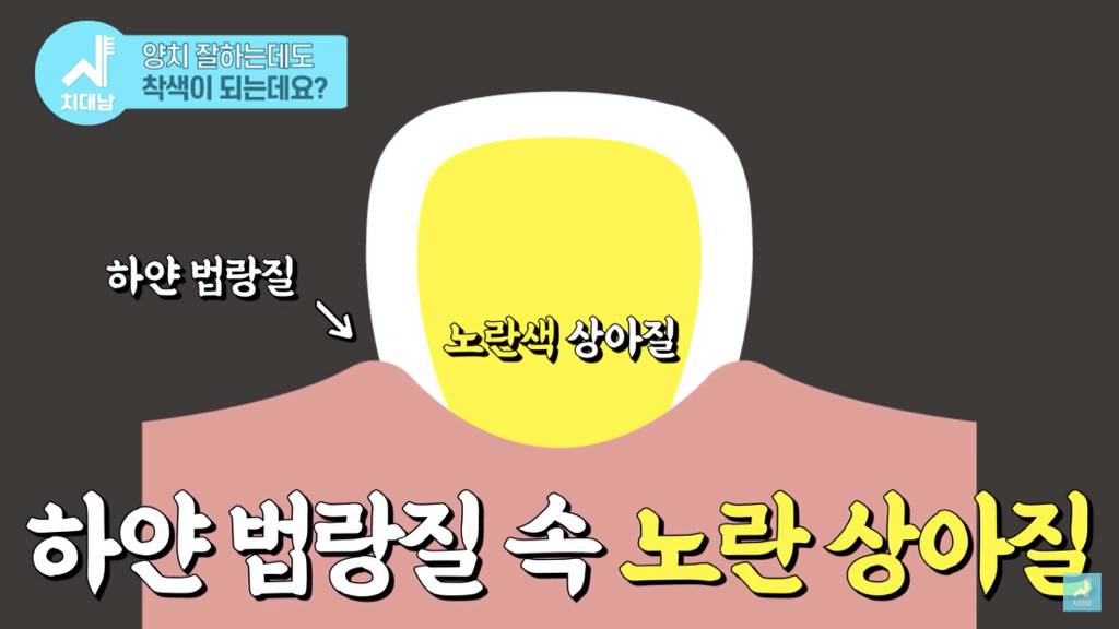 우리의 이빨이 존나 누렁니인 아주 놀라운 이유 | 인스티즈