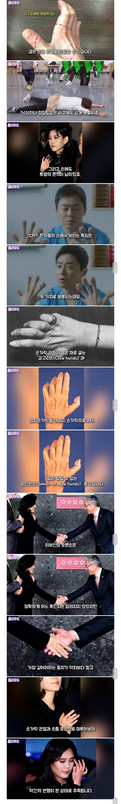 신라호텔 이부진 사장이 오른손을 감추려 하는 이유 | 인스티즈