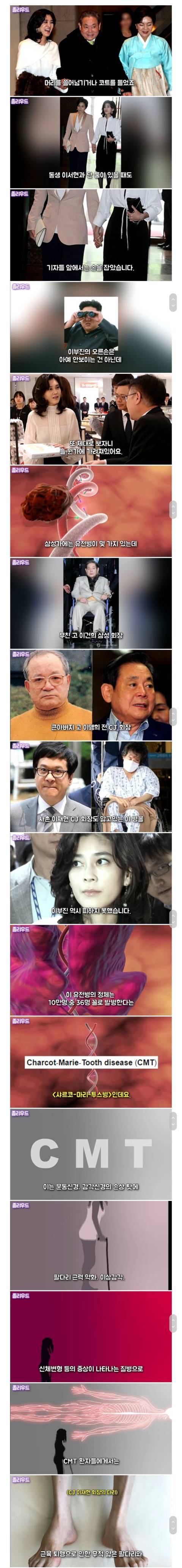 신라호텔 이부진 사장이 오른손을 감추려 하는 이유 | 인스티즈