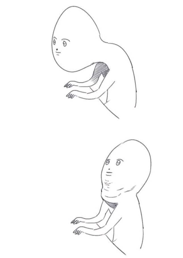 거북목인 사람들 특징.jpg | 인스티즈