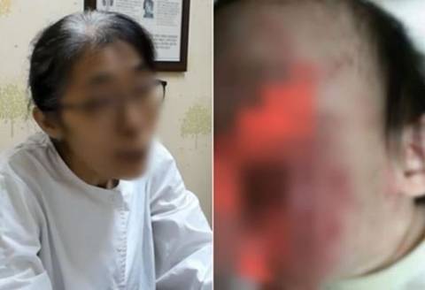 "누가 이기나 보자"…40도 고열인 아기에게 약 안 먹인 엄마 [이슈픽] | 인스티즈