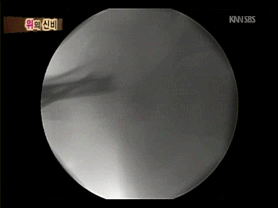 김희철 공익 판정 이유.jpg (feat.유승준) | 인스티즈