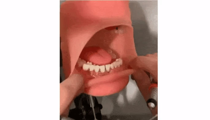 치과에서 의사가 원하는 입 벌리기.gif | 인스티즈