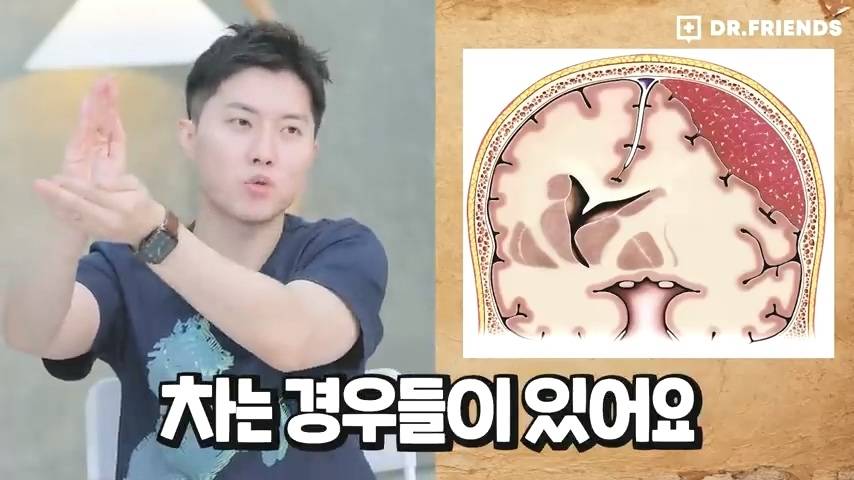 과거 사람들이 두통 생기면 뚝배기부터 열었던 이유 | 인스티즈