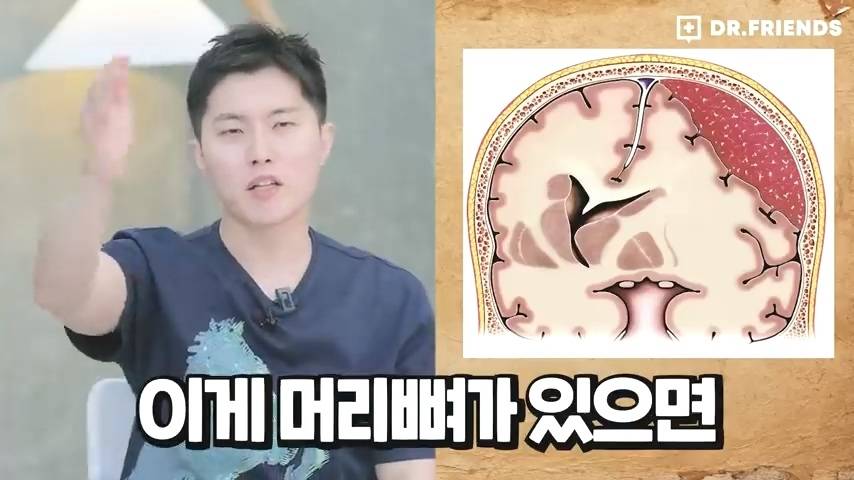 과거 사람들이 두통 생기면 뚝배기부터 열었던 이유 | 인스티즈