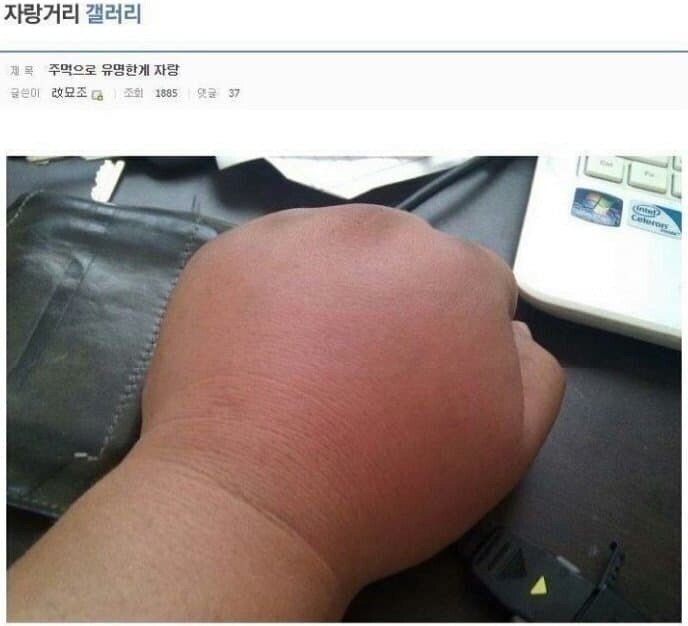 도라에몽 주먹으로 유명했던 디시인 근황.JPG | 인스티즈