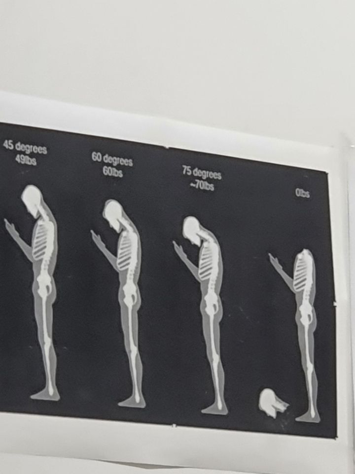 거북목의 최후.jpg | 인스티즈