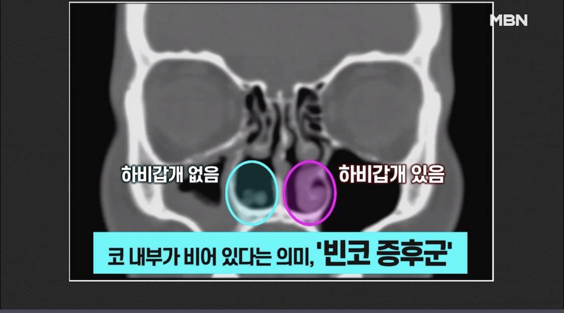 instiz
