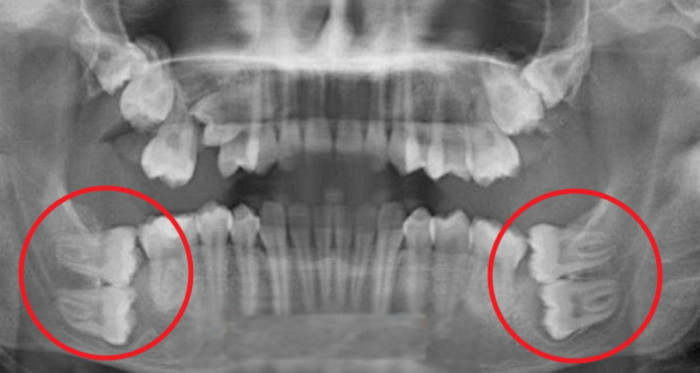 전생에 지은 죄가 많은 지 알아보는 방법 | 인스티즈
