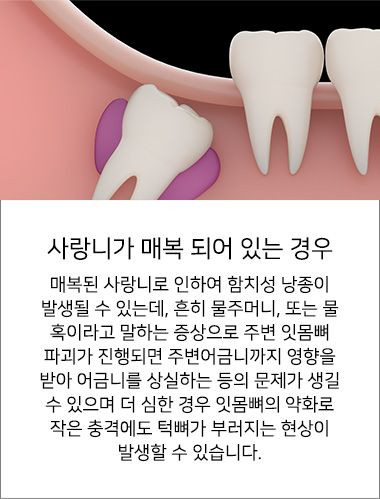 전생에 지은 죄가 많은 지 알아보는 방법 | 인스티즈