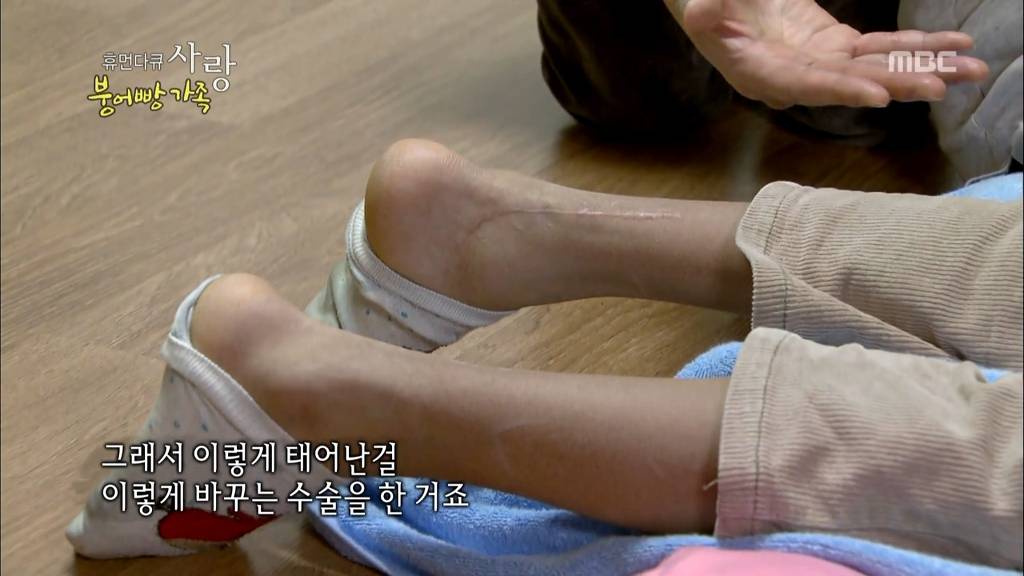 [다큐스폐셜] 입양 후 2년 반 만에 파양 된 9살 태준이.....JPG | 인스티즈